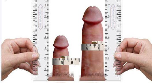 penis measurements for and after home augmentation